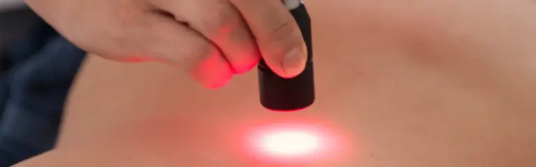 La foto mostra come viene effettuato un trattamento con LASER YAG